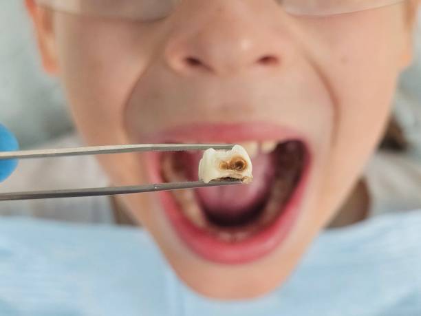 Best Pediatric Emergency Dentist in Arcade, GA